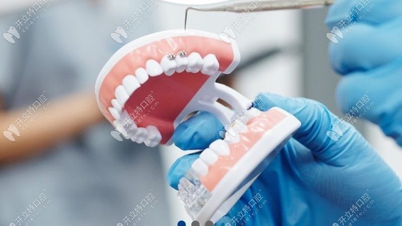 上海种牙医院预约挂号，如何选择正规诊所？**