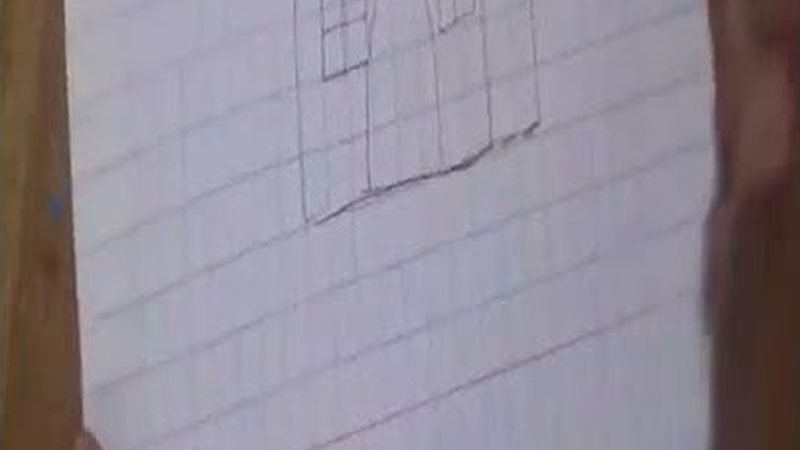 成人正畸保持器，如何选择性价比之选？**